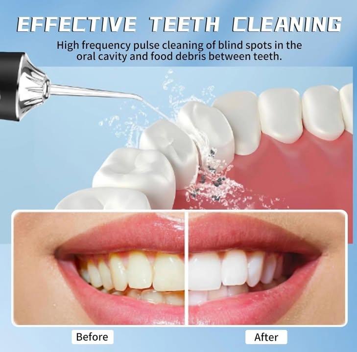 Yunlism 無線充電水牙線機 (9)